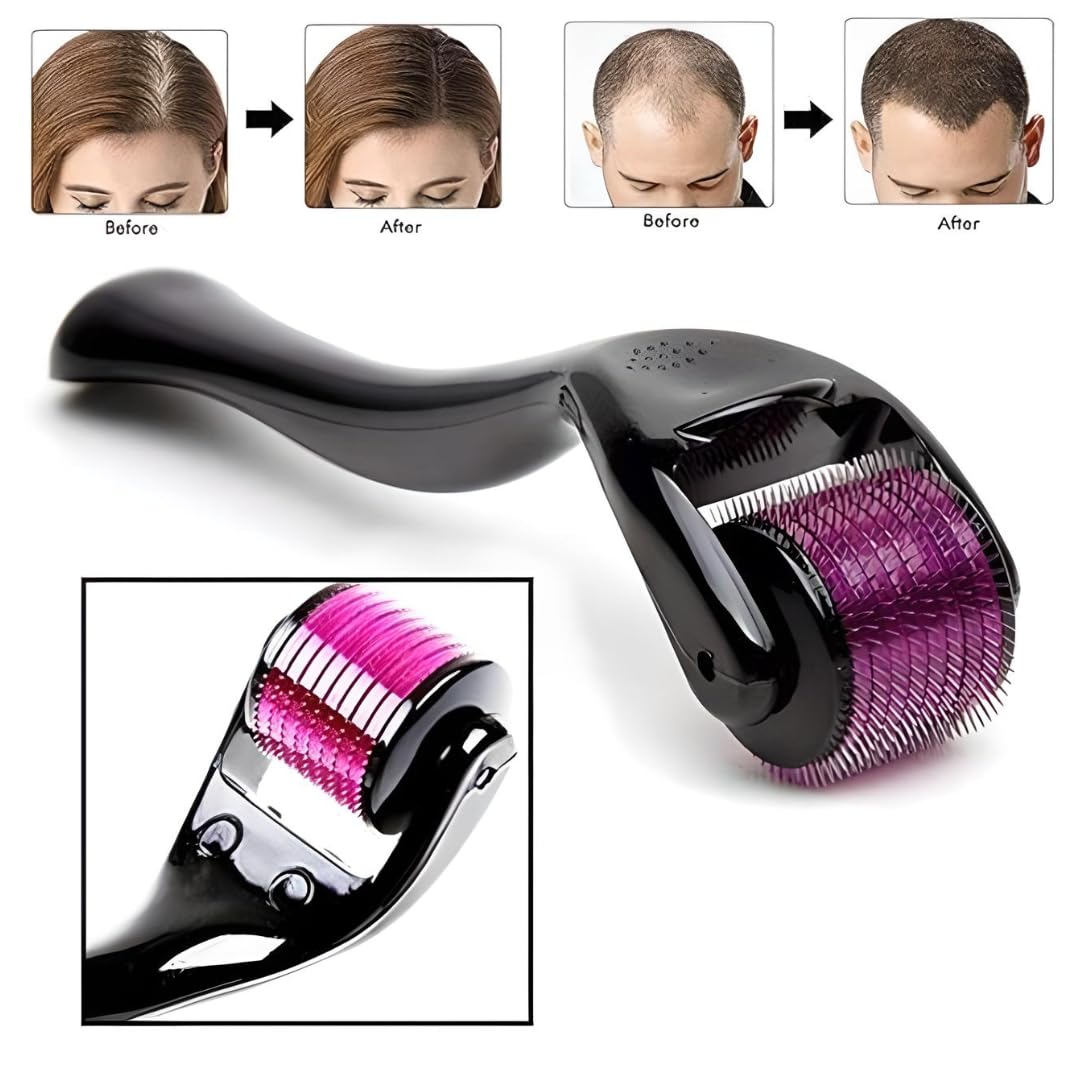 Derma Roller 0.5mm 540 Titanium Microneedles for Beard Growth I Hair Repair & Acne Scar Reduction I Men & Women (DERMA ROLLER BLACK-01)