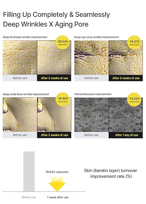 Vita-A Retinal Shot Tightening Booster with 0.1% Retinal, Matrixyl & Niacinamide | Pore Minimizer, Wrinkles & Fine Lines, Firmer Skin, Korean Face Serum (15ml)